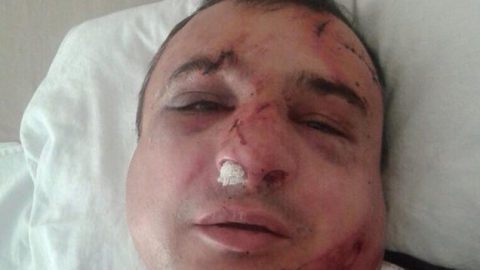 В Киеве избили одного из лидеров луганского сепаратизма В Киеве избили одного из лидеров луганского сепаратизма